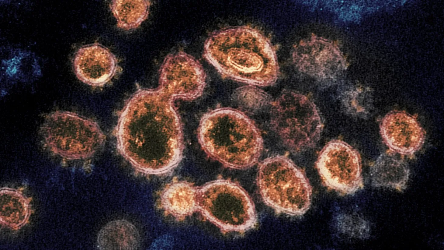The pandemic takes a turn toward personal responsibility