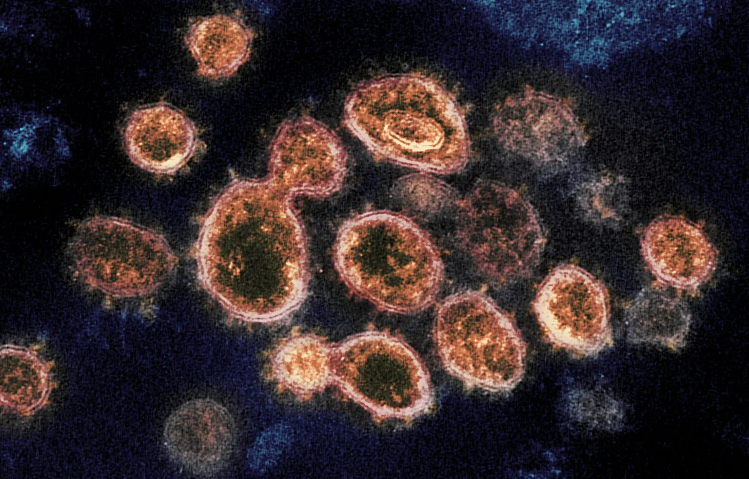 Political opportunism is dragging out the pandemic and state's fiscal uncertainty